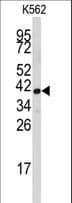 IHC-plus™ FBL / FIB / Fibrillarin Antibody (aa105-135)