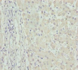 Polyclonal Rabbit anti-Human FMO5 Antibody (IHC, WB)