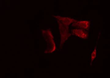 RAD23B / HR23B Antibody