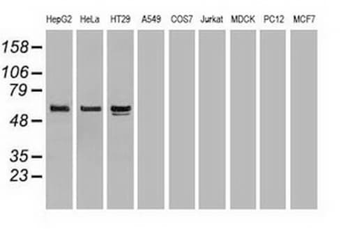 Alpha-Fetoprotein Antibody (aa19-397, clone OTI4G9)