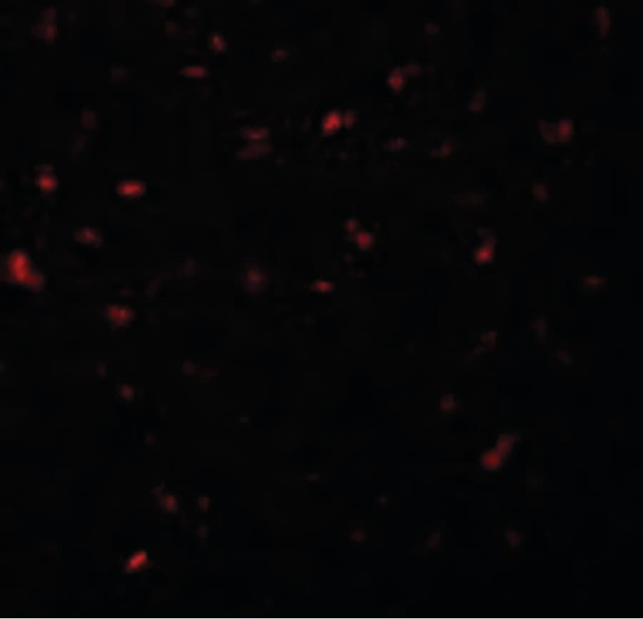 CALHM1 Antibody