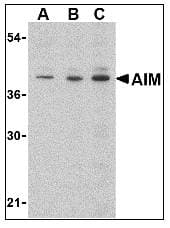 AIM / CD5L Antibody