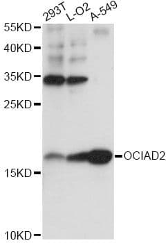 Polyclonal Rabbit anti-Human OCIAD2 Antibody (WB)