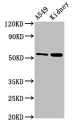 Polyclonal Rabbit anti-Human LACE1 Antibody (IHC, WB)