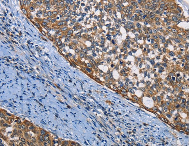 PGK1 / Phosphoglycerate Kinase Antibody