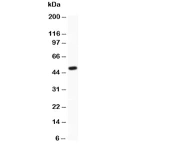 Polyclonal Rabbit anti-Human Laminin Antibody (IHC, WB)