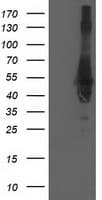 CCM2 / Malcavernin Antibody (clone OTI2C10)