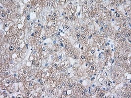 Heat Shock Protein 70 / HSPA1A Antibody (clone OTI3C6)