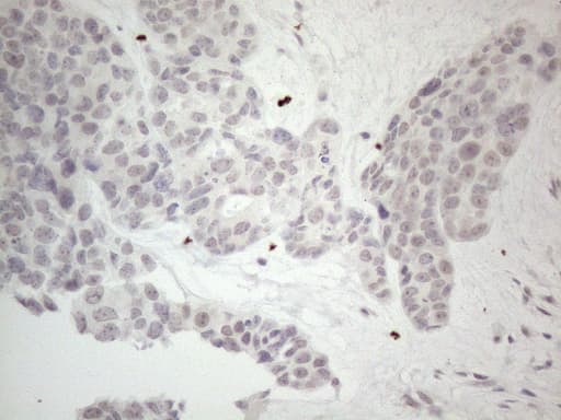 CSA / ERCC8 Antibody (clone OTI2G1, Carrier-free)