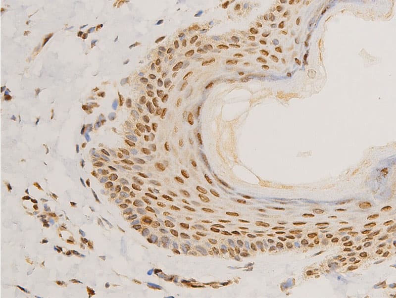 LMNA / Lamin A+C Antibody (phospho-Ser392)