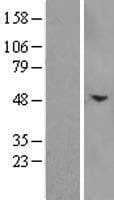 ACRV1/Intra-Acrosomal Protein (Over-Expression Lysate Myc-DDK (Flag))
