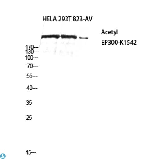 Polyclonal Rabbit anti-Human EP300 / p300 Antibody (WB)