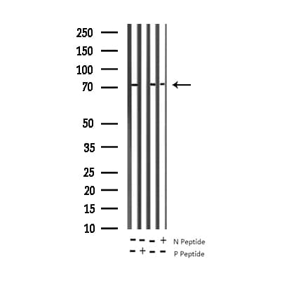 ADD1 / Adducin Alpha Antibody (phospho-Ser726)