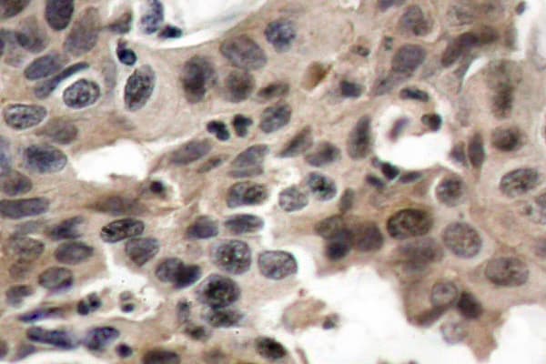 EIF4EBP1 / 4EBP1 Antibody (Pro30)
