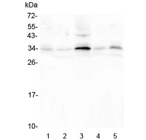 Polyclonal Rabbit anti-Human PPA1 Antibody (IHC, WB)