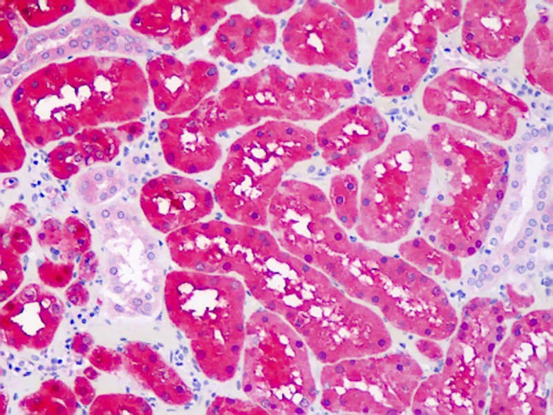 IHC-plus™ Monoclonal Mouse anti-Human CNDP2 Antibody (clone AT15E5, IHC, WB)