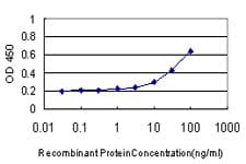 Monoclonal Mouse anti-Human IL-1B / IL-1 Beta Antibody (clone 2A8, IF, WB)