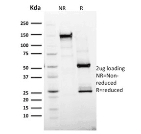 MKI67 / Ki67 Antibody (clone MKI67/2465)