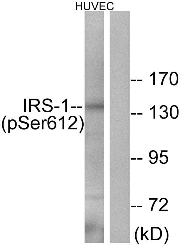 IRS1 Antibody (phospho-Ser612)