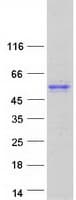 Human TRIOBP Protein (Recombinant Myc-DDK (Flag))