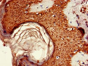 Polyclonal Rabbit anti-Human AKT1S1 / PRAS40 Antibody (IHC, WB)