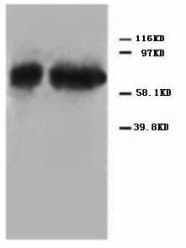 TP73 / p73 Antibody (C-Terminus)