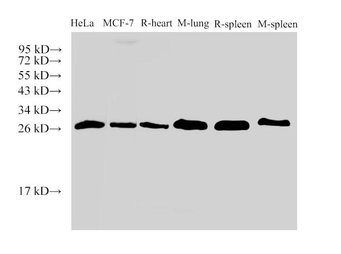LGALS3 / Galectin 3 Antibody