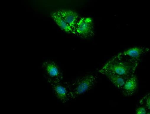 Monoclonal Mouse anti-Human Alpha-Fetoprotein Antibody (clone OTI2F11, aa19-397, IHC, IF, WB)