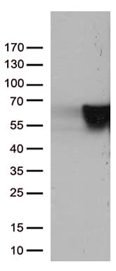 Vimentin Antibody (aa210-466, clone UMAB159)