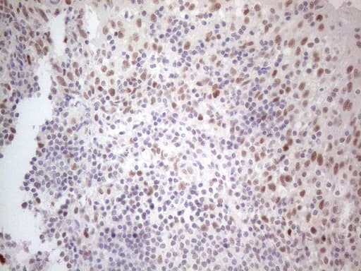 HDAC2 Antibody (aa415-488, clone OTI7E10)