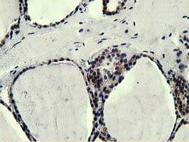 Monoclonal Mouse anti-Human L1CAM Antibody (clone OTI2H6, IHC, IF, WB)