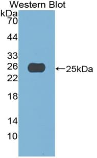 A1CF / ACF Antibody (aa389-587, APC)