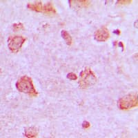 Polyclonal Rabbit anti-Human NDUFA4 Antibody (C-Terminus, IHC, IF, WB)