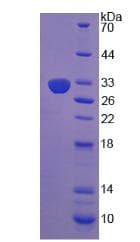 Human Dipeptidylpeptidase 8 / DPP8 Protein (Recombinant His-T7)