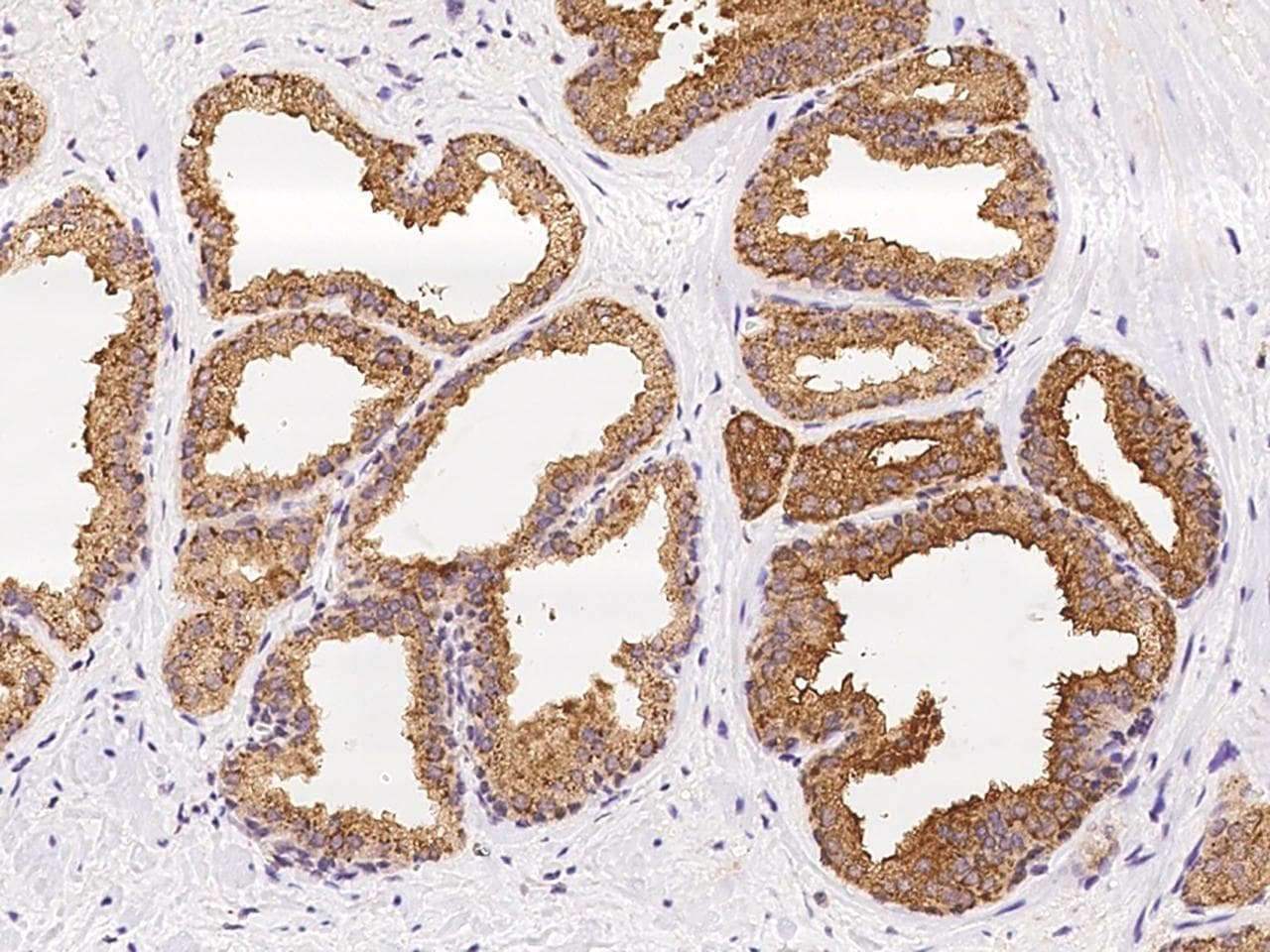 KLK4 / Kallikrein 4 Antibody