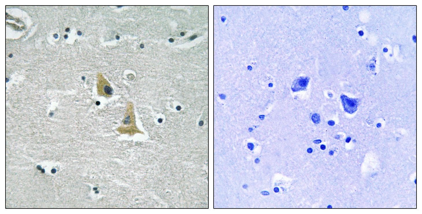 Polyclonal Rabbit anti-Human NCF1 / p47phox / p47 phox Antibody (p345, IHC, WB)