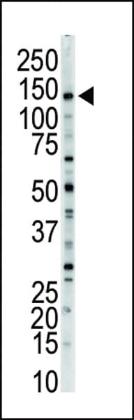 Polyclonal Rabbit anti-Human MYLK Antibody (aa923-953, IHC, WB)