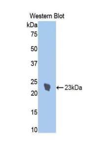 IL1R1 Antibody (aa386-553)