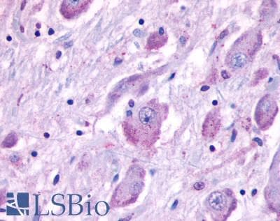 IHC-plus™ Polyclonal Rabbit anti-Human CELSR1 Antibody (N-Terminus, IHC)