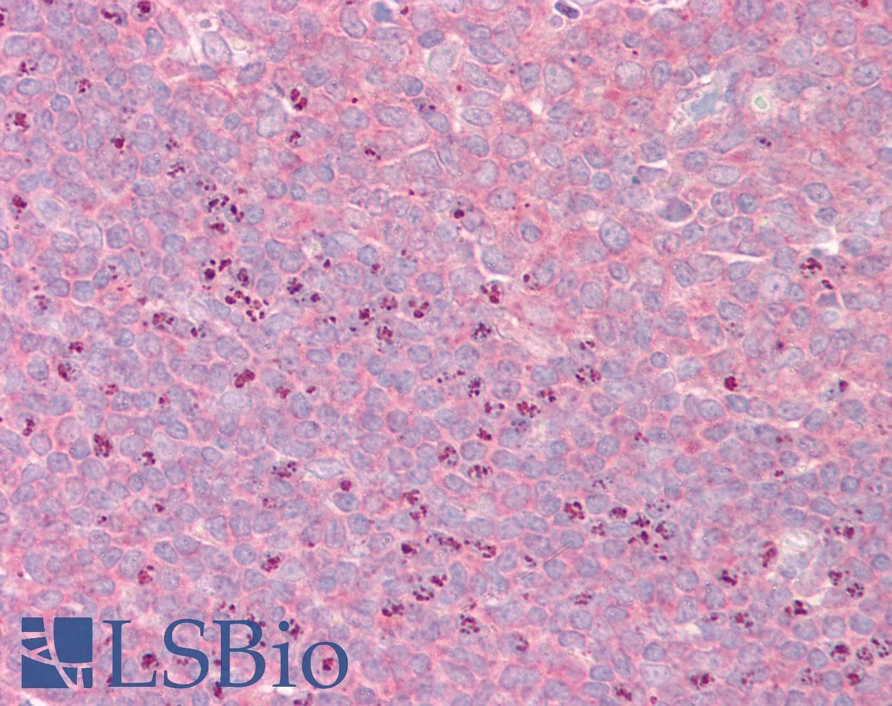 IHC-plus™ GRIPAP1 / GRASP1 Antibody (aa359-371)