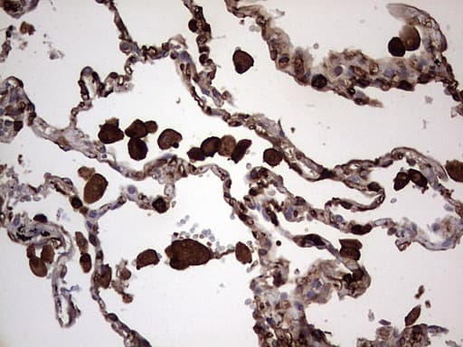 S100A9 / MRP14 Antibody (clone OTI11A12)