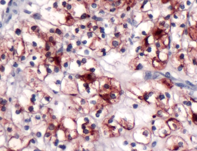 Monoclonal Mouse anti-Human PODXL / Podocalyxin Antibody (clone SPM487, IHC)