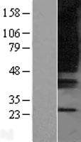 GPR80 / GPR99 / OXGR1 Protein (Over-Expression Lysate Myc-DDK (Flag))