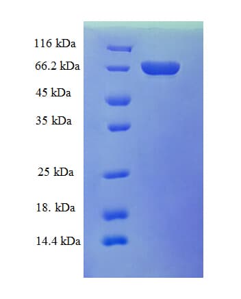 Human ADH5 Protein (Recombinant GST)
