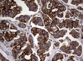 Monoclonal Mouse anti-Human TS / Thymidylate Synthase Antibody (clone 10F12, Carrier-free, IHC, WB)