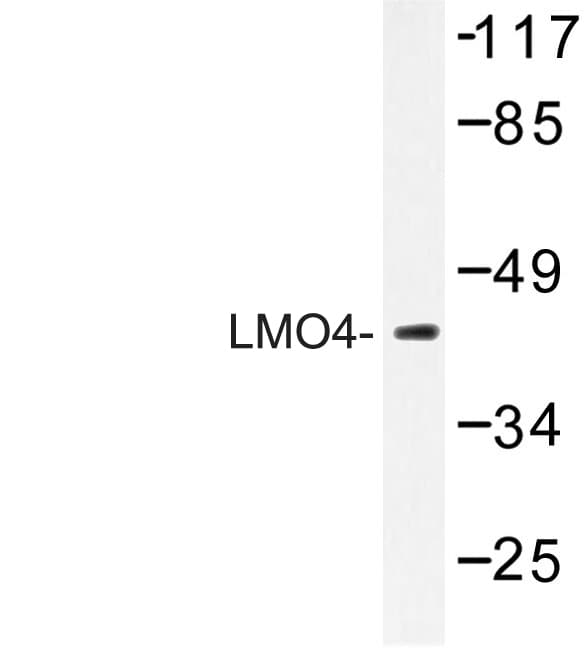LMO4 Antibody (Glu138)