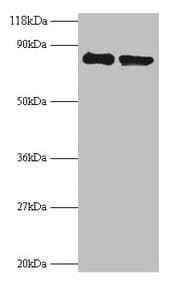 RPS10 / Ribosomal Protein S10 Antibody