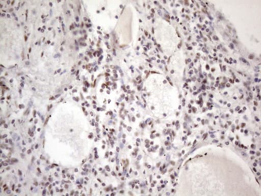 TP53BP1 / 53BP1 Antibody (aa1-300, clone OTI2H6)