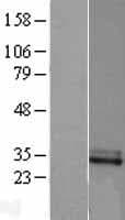 CFHR2 Protein (Over-Expression Lysate Myc-DDK (Flag))