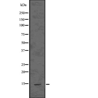 ASIP Antibody